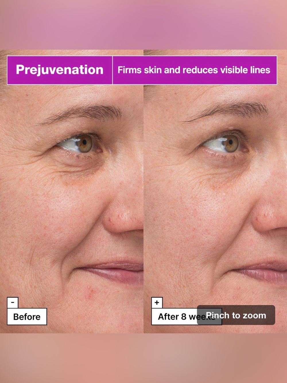 NWT Dr. Jart+ Prejuvenation Firming Bakuchiol Serum for Preventative Aging - Picture 9 of 13